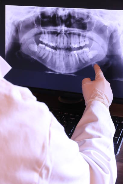 Best Emergency Dental Extractions in Johnston, SC