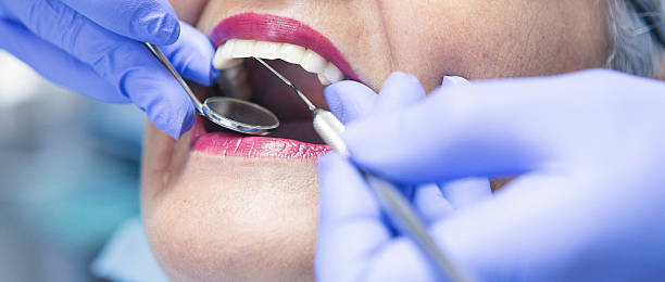 Best Emergency Dental Services for Seniors in Johnston, SC